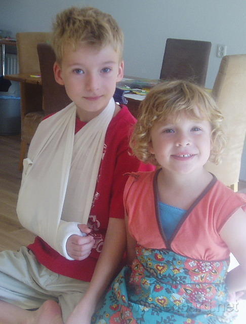 Twee dagen later loopt Jesper met een gebriken arm rond